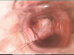 Le tumbling et le sexe dila